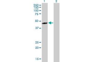 Western Blot analysis of RECQL5 expression in transfected 293T cell line by RECQL5 MaxPab polyclonal antibody.