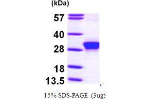 rho Family GTPase 3 (RND3) (AA 1-241) protein (His tag)