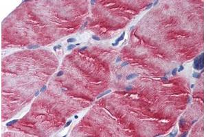 Human Skeletal Muscle (formalin-fixed, paraffin-embedded) stained with MYO5B antibody ABIN305726 at 2. (MYO5B antibody  (N-Term))