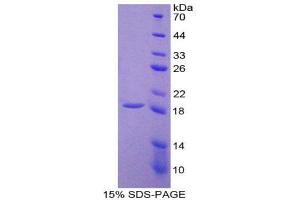 SDS-PAGE (SDS) image for Thrombomodulin (THBD) (AA 31-167) protein (His tag) (ABIN1171440)