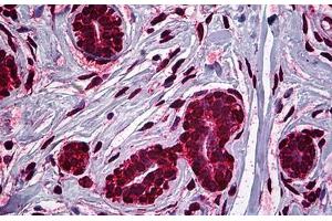 Immunohistochemistry (Formalin-fixed Paraffin-embedded Sections) (IHC (fp)) image for anti-Mdm2, p53 E3 Ubiquitin Protein Ligase Homolog (Mouse) (MDM2) (AA 101-201) antibody (ABIN626102)
