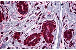 Human Breast: Formalin-Fixed, Paraffin-Embedded (FFPE) (MDM2 antibody  (AA 101-201))