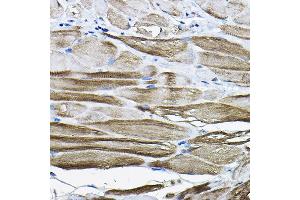 Immunohistochemistry of paraffin-embedded mouse stomach using LDB3 Rabbit pAb (ABIN6128179, ABIN6143125, ABIN6143126 and ABIN6223347) at dilution of 1:200 (40x lens). (LIM Domain Binding 3 Protein antibody  (AA 1-283))
