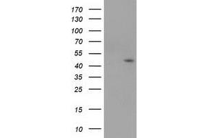 Image no. 1 for anti-serpin Peptidase Inhibitor, Clade B (Ovalbumin), Member 4 (SERPINB4) antibody (ABIN1500889) (SERPINB4 antibody)