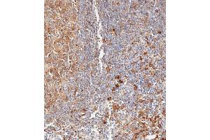 Immunohistochemistry (Paraffin-embedded Sections) (IHC (p)) image for anti-Major Histocompatibility Complex, Class II, DP beta 1 (HLA-DPB1) (AA 77-105) antibody (ABIN657755)