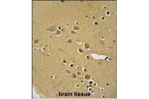 Immunohistochemistry (Paraffin-embedded Sections) (IHC (p)) image for anti-Amylase, alpha 2B (Pancreatic) (AMY2B) (AA 74-100), (N-Term) antibody (ABIN654651)