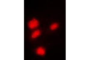 Immunofluorescent analysis of CREB staining in Hela cells.