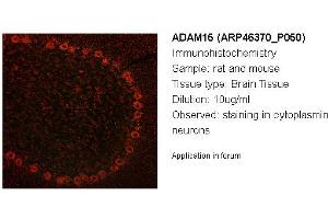 Image no. 2 for anti-ADAM Metallopeptidase Domain 15 (ADAM15) (Middle Region) antibody (ABIN405816) (ADAM15 antibody  (Middle Region))