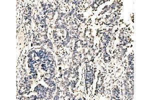 IHC analysis of KI/VIRMA using anti-KI/VIRMA antibody (ABIN7599707). (Protein Virilizer Homolog (VIRMA) (AA 11-1529) antibody)