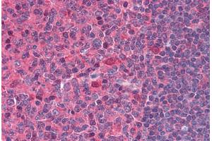Human Tonsil: Formalin-Fixed, Paraffin-Embedded (FFPE) (DNASE1 antibody  (AA 1-252))