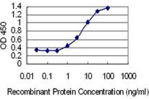 Detection limit for recombinant GST tagged FAM44C is 0. (BOD1L2 antibody  (AA 1-172))