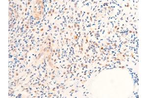 ABIN6267073 at 1/100 staining rat appendiceal tissue sections by IHC-P. (CHEK1 antibody  (pSer280))