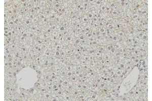 ABIN6274798 at 1/100 staining Mouse liver tissue by IHC-P. (ACSS1 antibody  (C-Term))