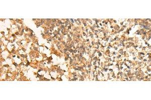 Immunohistochemistry of paraffin-embedded Human tonsil tissue using CEP57 Polyclonal Antibody at dilution of 1:30(x200) (CEP57 antibody)