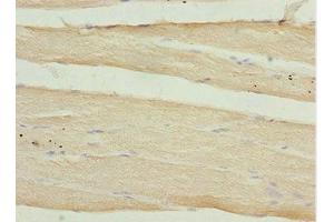 Immunohistochemistry of paraffin-embedded human skeletal muscle tissue using ABIN7146349 at dilution of 1:100 (CALCOCO2 antibody  (AA 137-446))