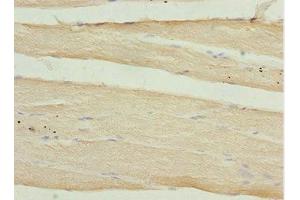 Immunohistochemistry of paraffin-embedded human skeletal muscle tissue using ABIN7146349 at dilution of 1:100