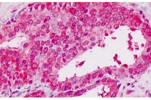 Human Prostate: Formalin-Fixed, Paraffin-Embedded (FFPE) (STAT2 antibody  (C-Term))