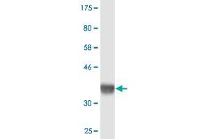Western Blot detection against Immunogen (36. (SETDB2 antibody  (AA 451-550))