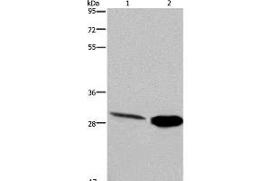 Western Blot analysis of Human hepatocellular carcinoma and Mouse skeletal muscle tissue using CA3 Polyclonal Antibody at dilution of 1:200