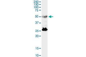 TFEB monoclonal antibody (M01), clone S1. (TFEB antibody  (AA 1-476))