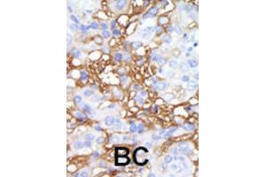 Immunohistochemistry (IHC) image for anti-Mitogen-Activated Protein Kinase Kinase Kinase Kinase 1 (MAP4K1) antibody (ABIN3003610)