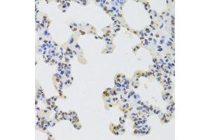 Immunohistochemistry (Paraffin-embedded Sections) (IHC (p)) image for anti-Heterogeneous Nuclear Ribonucleoprotein D (HNRNPD) (AA 1-306) antibody (ABIN6141905)