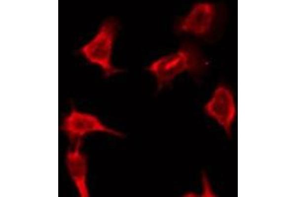 OR9Q2 antibody  (C-Term)