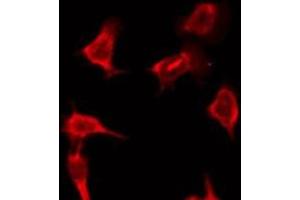 ABIN6276197 staining HeLa by IF/ICC. (OR9Q2 antibody  (C-Term))
