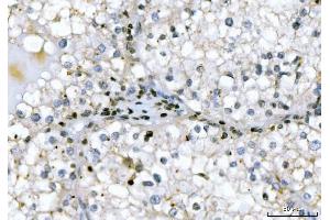 IHC analysis of GADD45B using anti-GADD45B antibody (ABIN7603219). (GADD45B antibody  (N-Term))