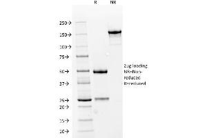 SDS-PAGE Analysis Purified RCC Mouse Monoclonal Antibody (66.