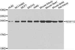 Western blot analysis of extracts of various cell lines, using NDUFV2 antibody (ABIN5975536) at 1/1000 dilution. (NDUFV2 antibody)