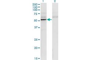 Western Blot analysis of CYP26B1 expression in transfected 293T cell line by CYP26B1 monoclonal antibody (M01), clone 1H6.