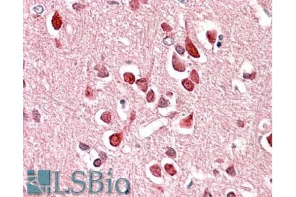Unc5c antibody  (Internal Region)
