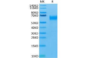 Human SIRP Beta 1 isoform 3 on Tris-Bis PAGE under reduced condition.