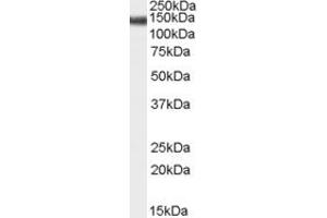Western Blotting (WB) image for anti-Abhydrolase Domain Containing 17C (ABHD17C) (Middle Region) antibody (ABIN2791515) (ABHD17C antibody  (Middle Region))