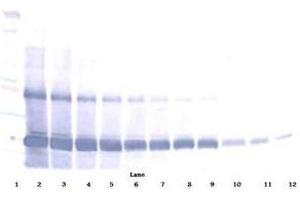 Image no. 3 for anti-AIMP1 / EMAP II antibody (ABIN465272) (AIMP1 / EMAP II antibody)