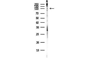 anti-Chromosome 16 Open Reading Frame 62 (C16orf62) antibody