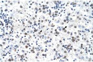 Immunohistochemical staining (Formalin-fixed paraffin-embedded sections) of human liver with FECH polyclonal antibody  at 4-8 ug/mL working concentration. (FECH antibody  (N-Term))