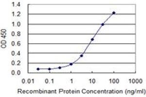 Detection limit for recombinant GST tagged VWF is 0. (VWF antibody  (AA 1-273))