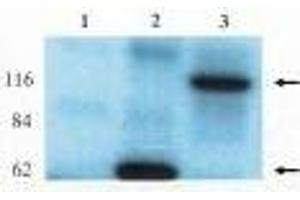 Western blot analysis using anti-Lfc antibody on HEK-293 cell transfected with vector alone (1), lfc-short (2) and lfc-long (3). (ARHGEF2 antibody)