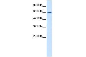 Western Blot showing ZNF12 antibody used at a concentration of 1-2 ug/ml to detect its target protein.