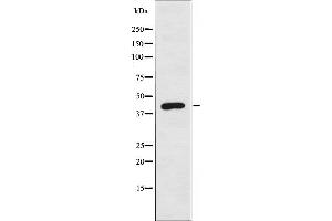 Western blot analysis of extracts from 293 cells, using EKI2 antibody.