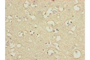 Immunohistochemistry of paraffin-embedded human brain tissue using ABIN7151390 at dilution of 1:100 (ENPP6 antibody  (AA 31-330))