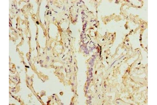 SLA antibody  (AA 2-276)
