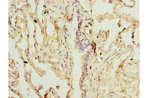 Immunohistochemistry of paraffin-embedded human lung tissue using ABIN7170672 at dilution of 1:100 (SLA antibody  (AA 2-276))