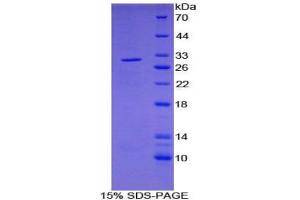 SDS-PAGE analysis of Human PDP Protein. (PDP Protein)