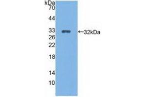 Detection of Recombinant CYP27B1, Rat using Polyclonal Antibody to Cytochrome P450 27B1 (CYP27B1) (CYP27B1 antibody  (AA 251-500))
