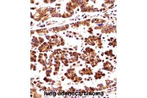Immunohistochemistry (IHC) image for anti-Origin Recognition Complex, Subunit 3 (ORC3) antibody (ABIN2998313) (ORC3 antibody)