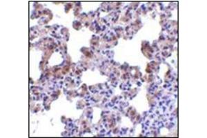 Immunohistochemistry of PEN2 in rat lung tissue with this product at 2.