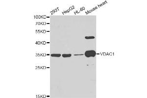 Western blot analysis of extracts of various cell lines, using VDAC1 antibody. (VDAC1 antibody)